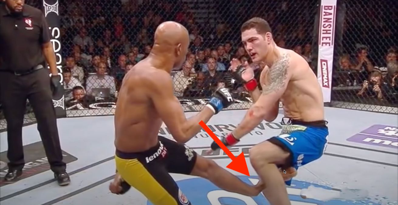 Top 10 Worst UFC Injuries Ever That Are Disgusting – Top Sporter